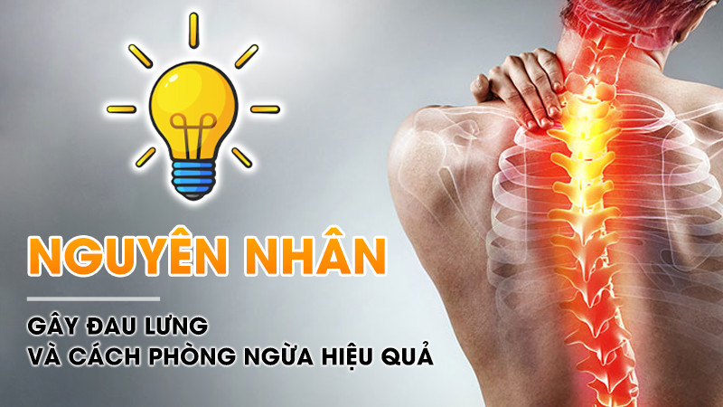 Nguyên nhân gây đau lưng là gì? Cách khắc phục, điều trị hiệu quả nhất