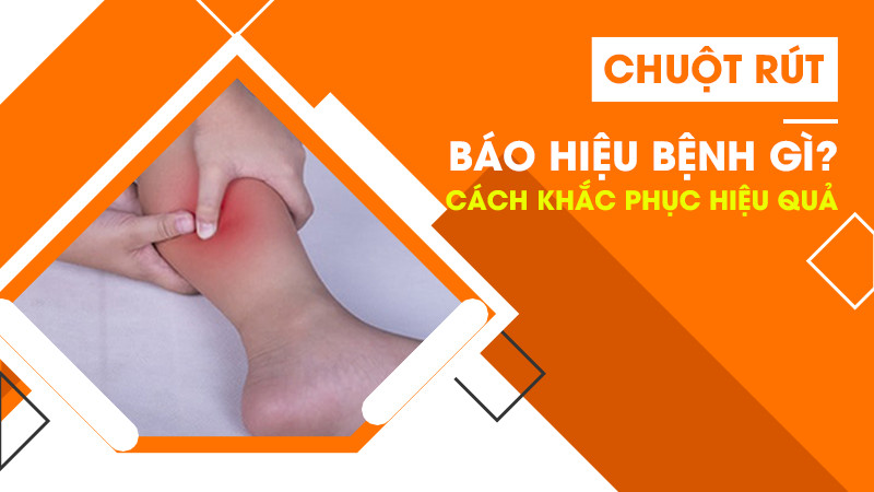 Chuột rút báo hiệu bệnh gì? Cách khắc phục hiệu quả nhất