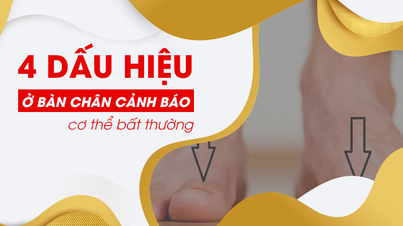 4 dấu hiệu bàn chân cảnh báo cơ thể bất thường