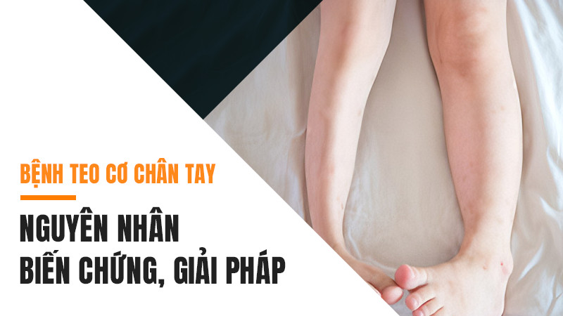 Bệnh teo cơ chân tay | Nguyên nhân, biến chứng, giải pháp khắc phục hiệu quả